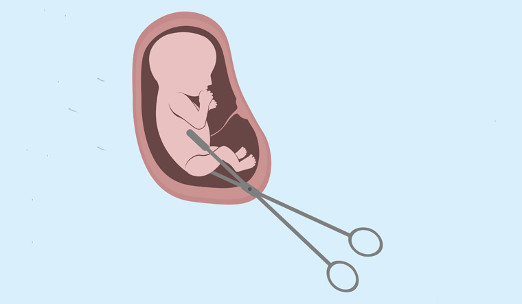 Abortion Woman Pregnant Pregnancy Shut