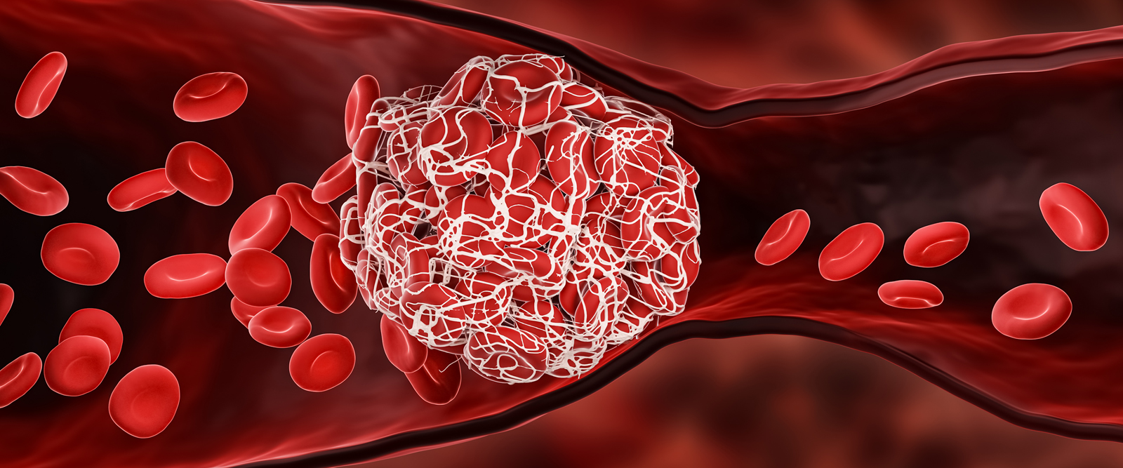 Covid 19 Blood Clots Hero